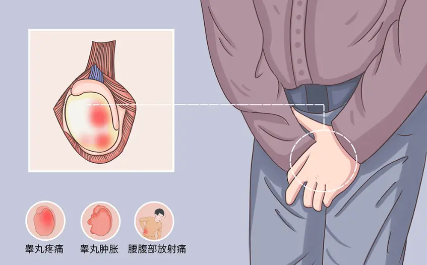 今日精选：南通正规男科医院“排名一览”睾丸里面有个硬疙瘩是怎么回事？
