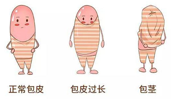 健康热点：南通专业的男科医院“聚焦男科”包皮过长包茎有什么区别？